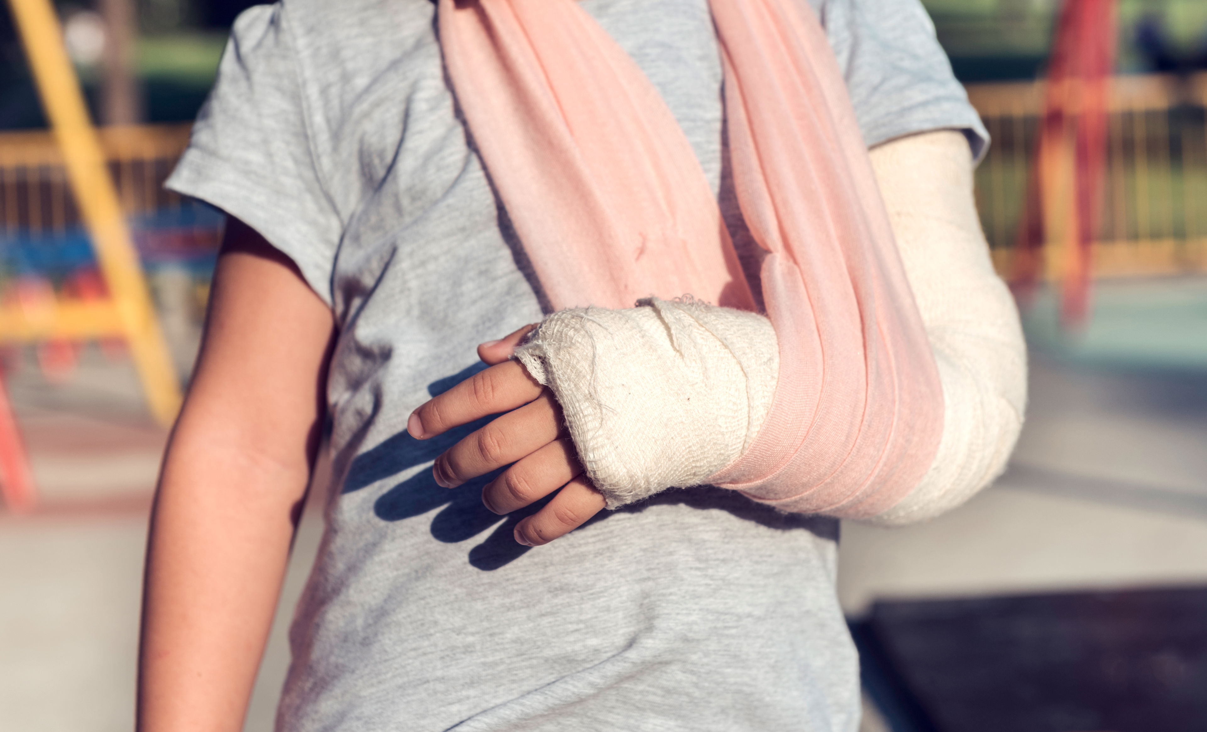 Barn med arm i gips